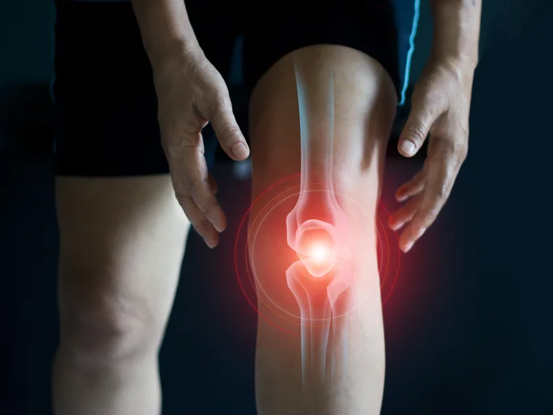 How Carlisle Spine And Wellness treats arthritis in Carlisle